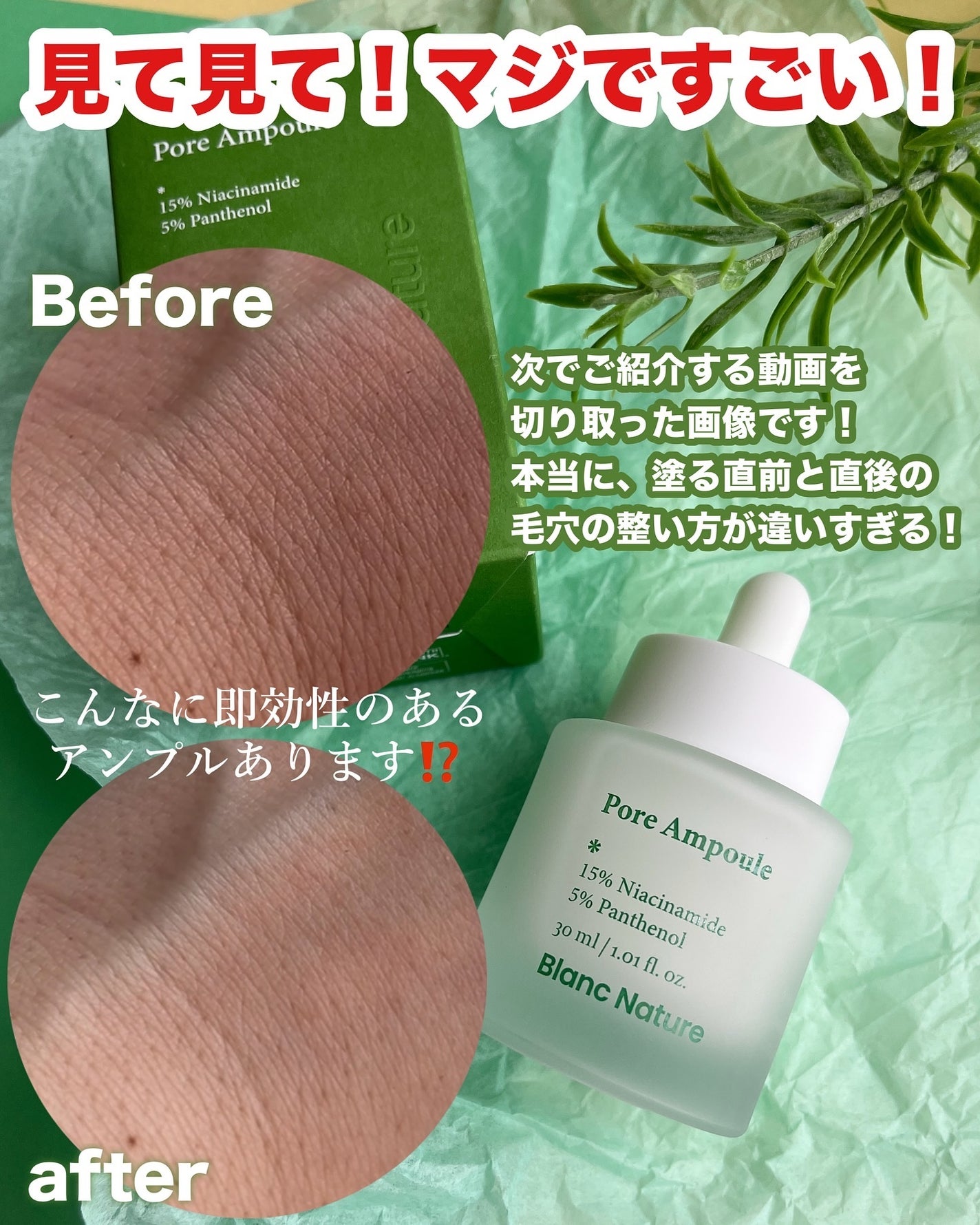 毛穴アンプル/ブラン/美容液を使ったクチコミ(4枚目)