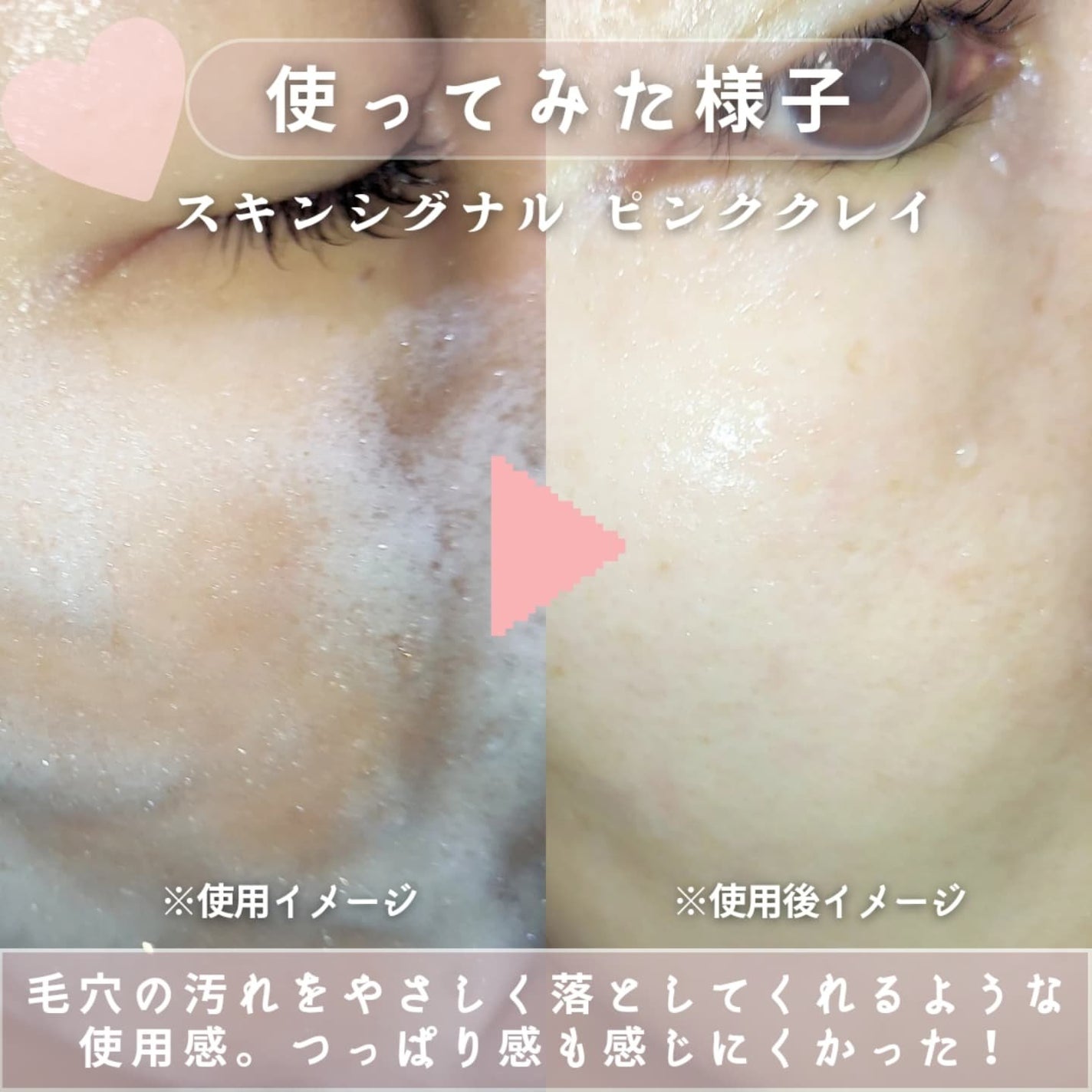 ピンククレイ酵素クレンザー/SKIN SIGNAL/洗顔パウダーを使ったクチコミ(5枚目)