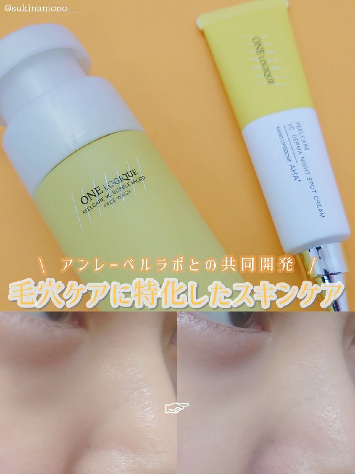ピールケア VCバブルマイクロ フェイスウォッシュ/ONE LOGIQUE/泡洗顔を使ったクチコミ(1枚目)