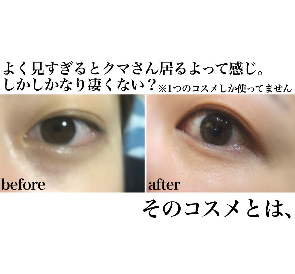 &be ファンシーラー/&be/パレットコンシーラーを使ったクチコミ(2枚目)