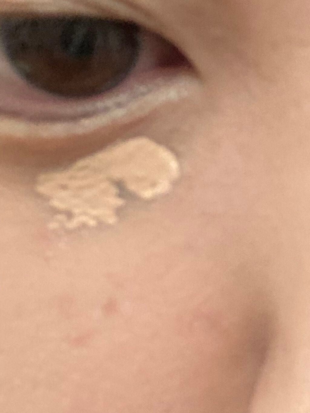 【旧】ディオールスキン フォーエヴァー スキン コレクト コンシーラー/Dior/リキッドコンシーラーを使ったクチコミ(2枚目)