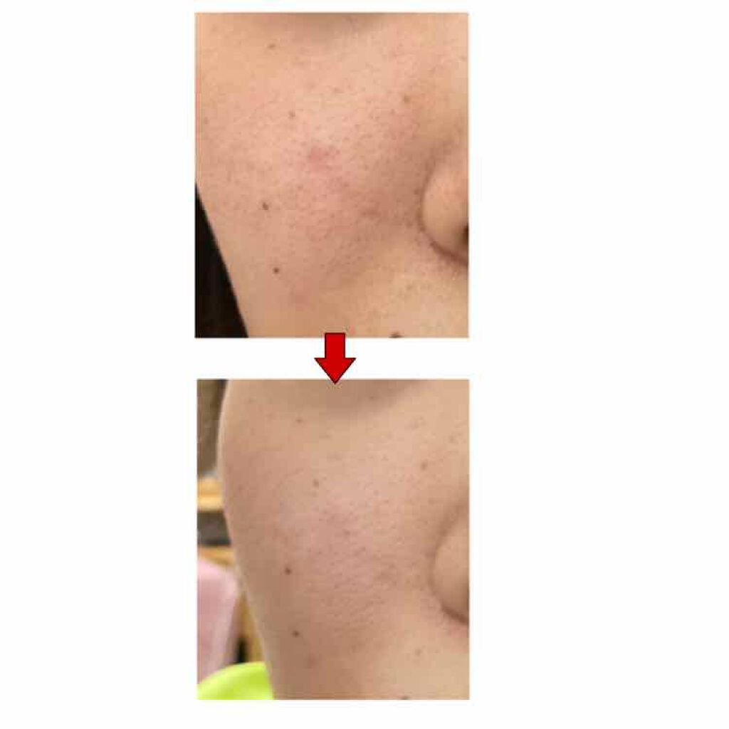 ロゼット洗顔パスタ 海泥スムース/ロゼット/洗顔フォームを使ったクチコミ（3枚目）