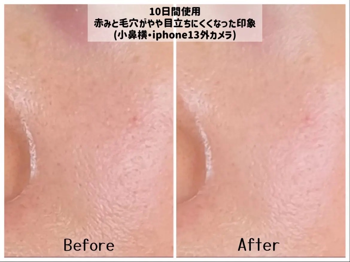 TXトーニングクリーム/VT/フェイスクリームを使ったクチコミ（3枚目）