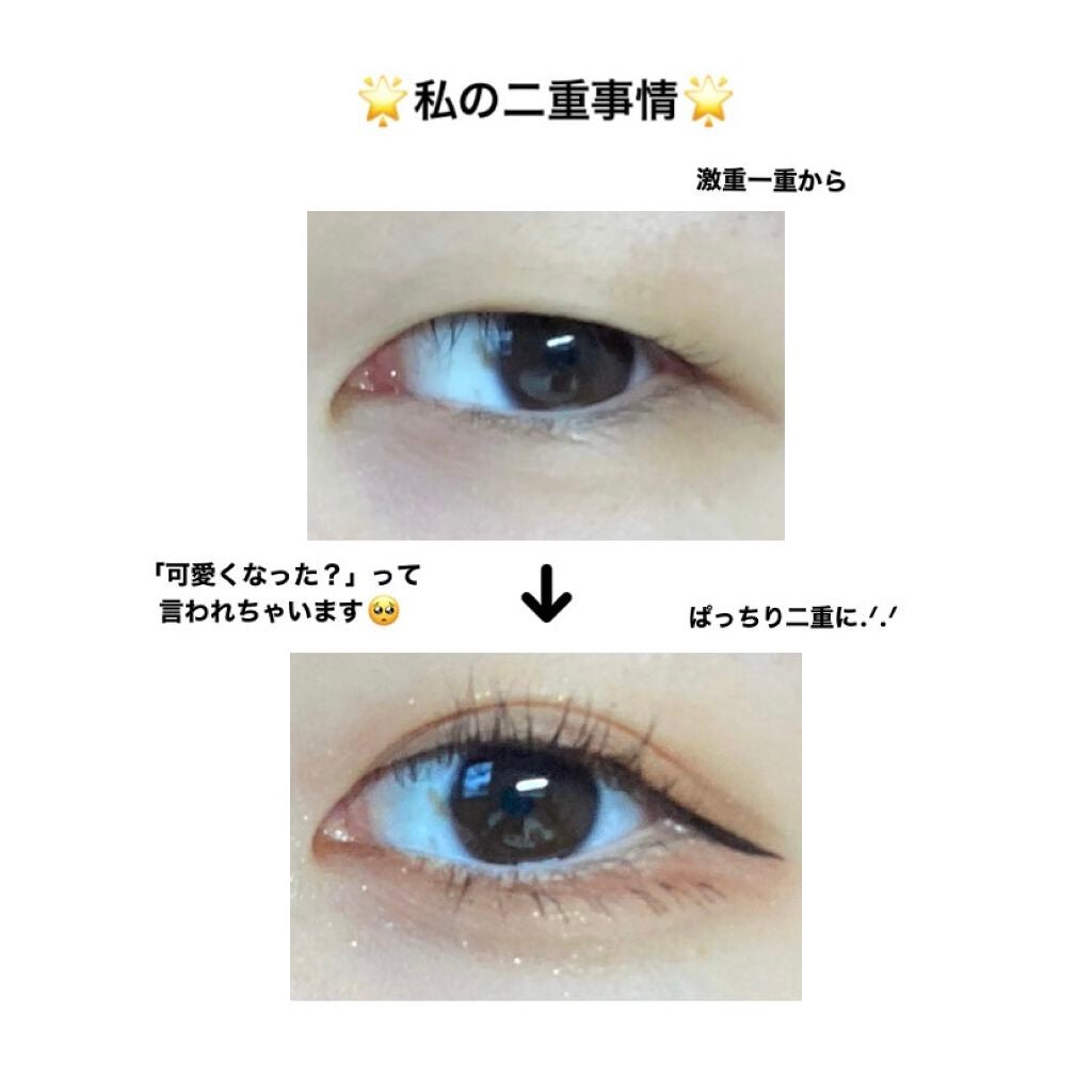 アイトーク/アイトーク/二重まぶた用アイテムを使ったクチコミ(1枚目)