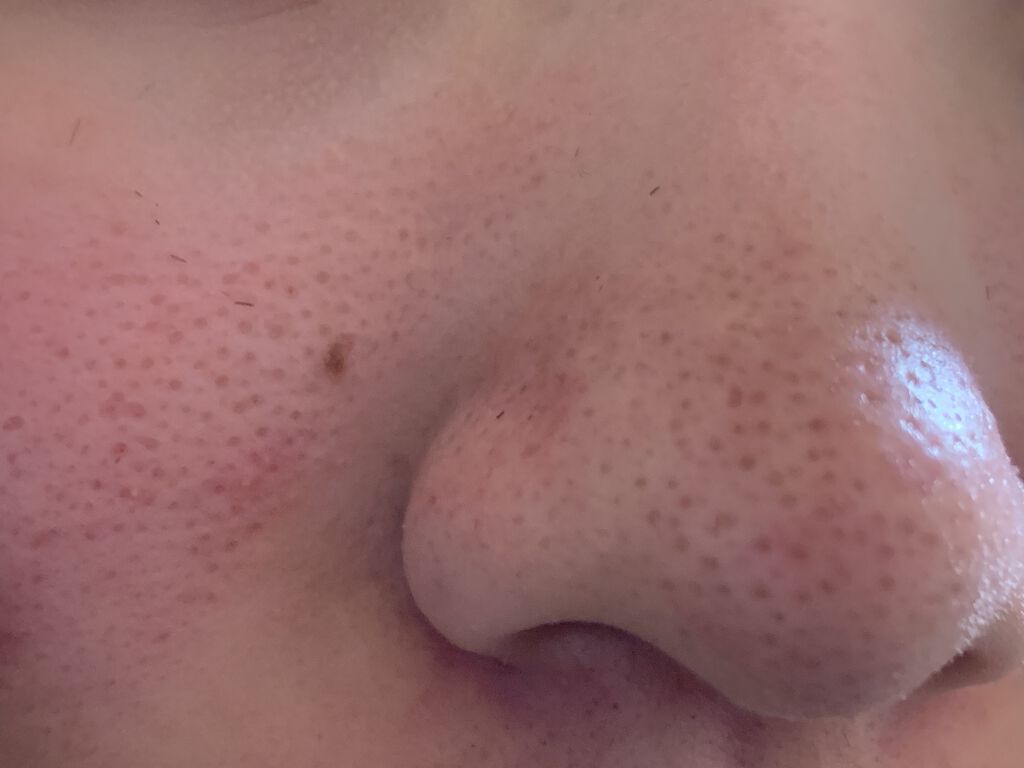 乳液・敏感肌用・高保湿タイプ/無印良品/乳液を使ったクチコミ（2枚目）