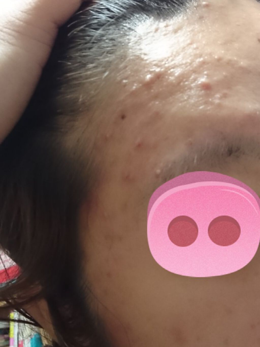 スチーマー ナノケア EH-SA37/Panasonic/美顔器・マッサージを使ったクチコミ（3枚目）