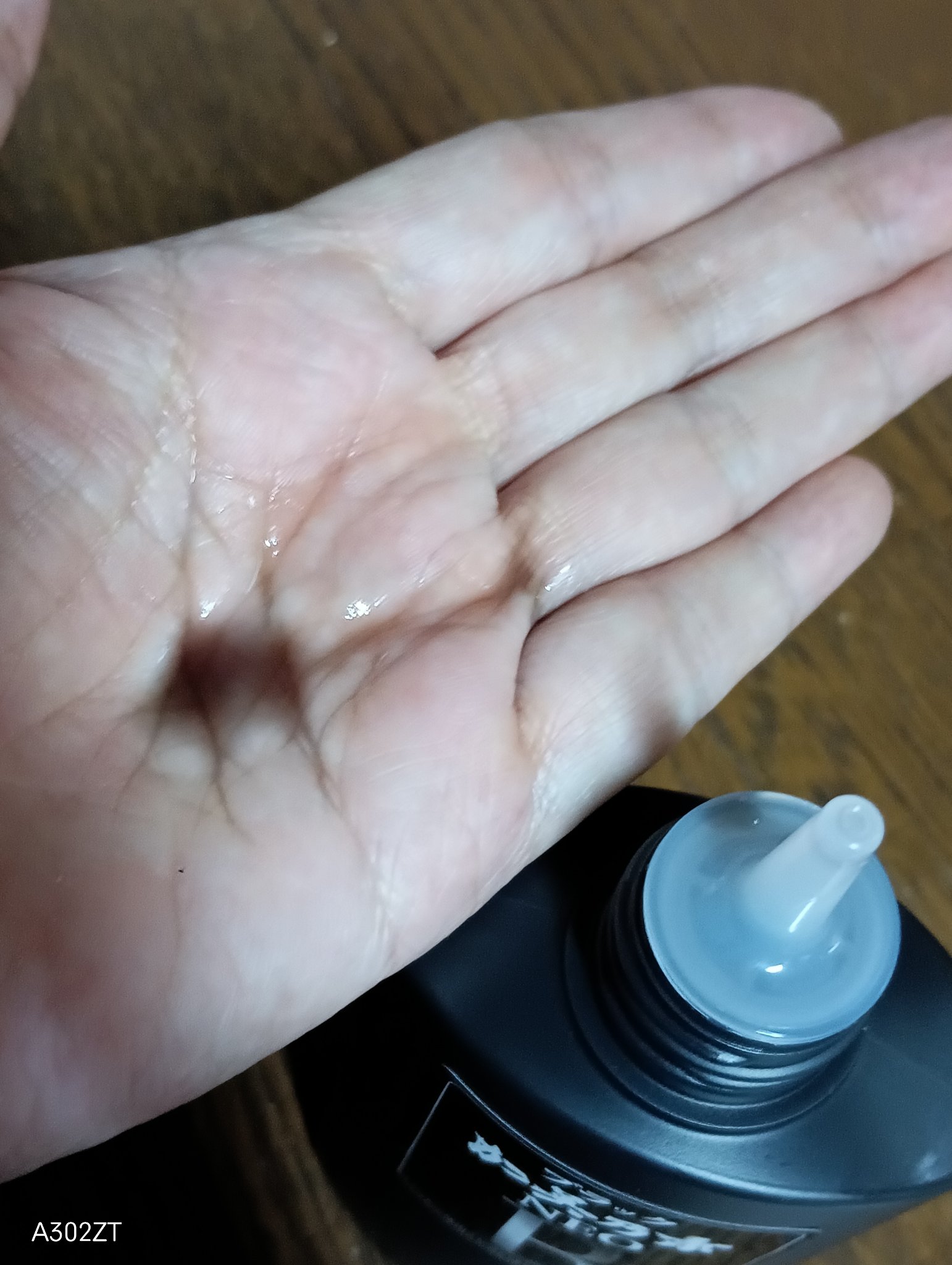 ブラック加美乃素NEO/加美乃素本舗/頭皮ローションを使ったクチコミ（2枚目）