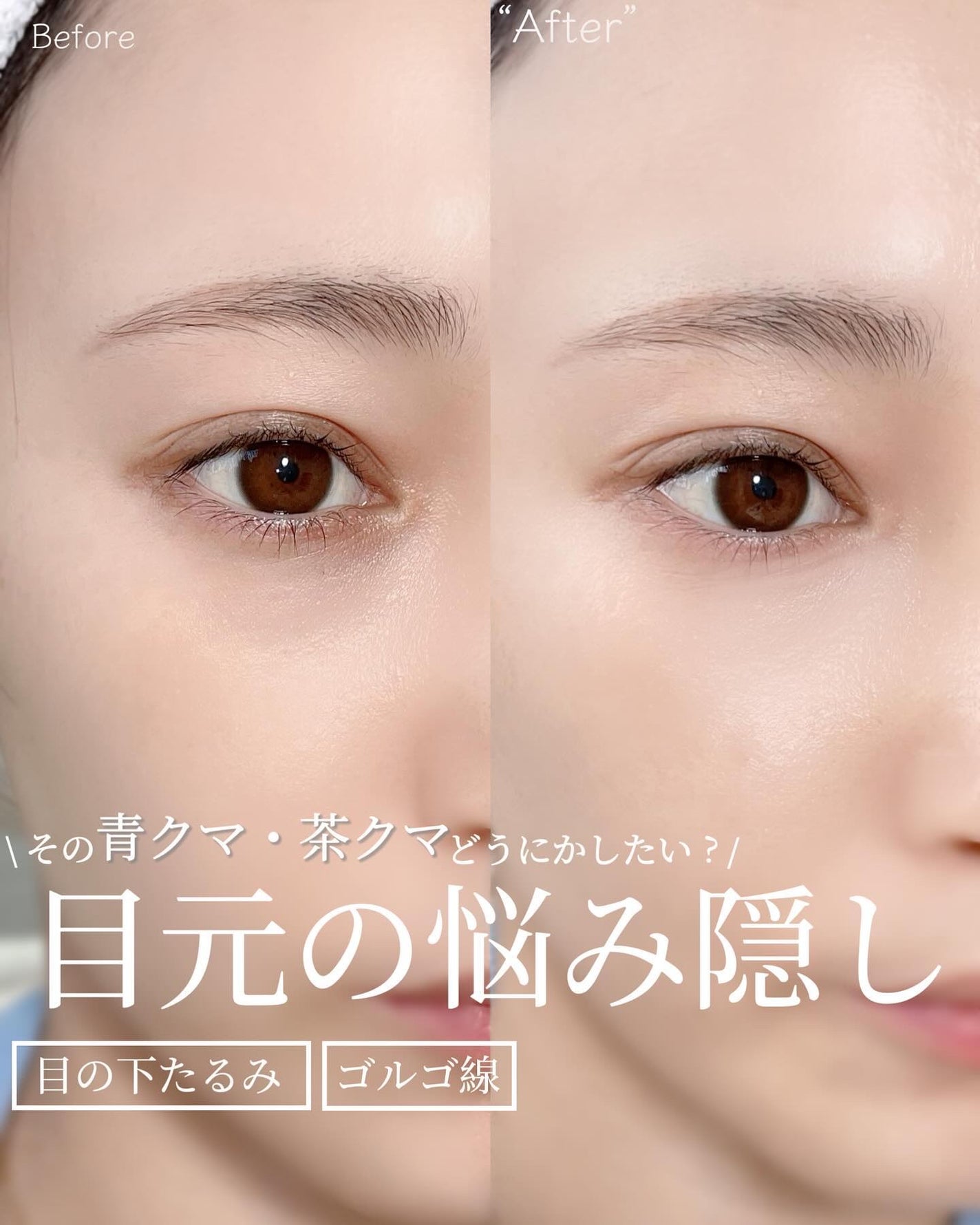 Karin.ðŠâªï¿€ã«ã©ã³ã³ã¬ãðïœLens Log  on LIPS ãæ©ã¿å¥è§£æ¶æ³âä¿åçâ//ç®å
ã®ã¯ããããã¿ã®æ©ã¿ãããèããŸ..ãïŒ1æç®ïŒ