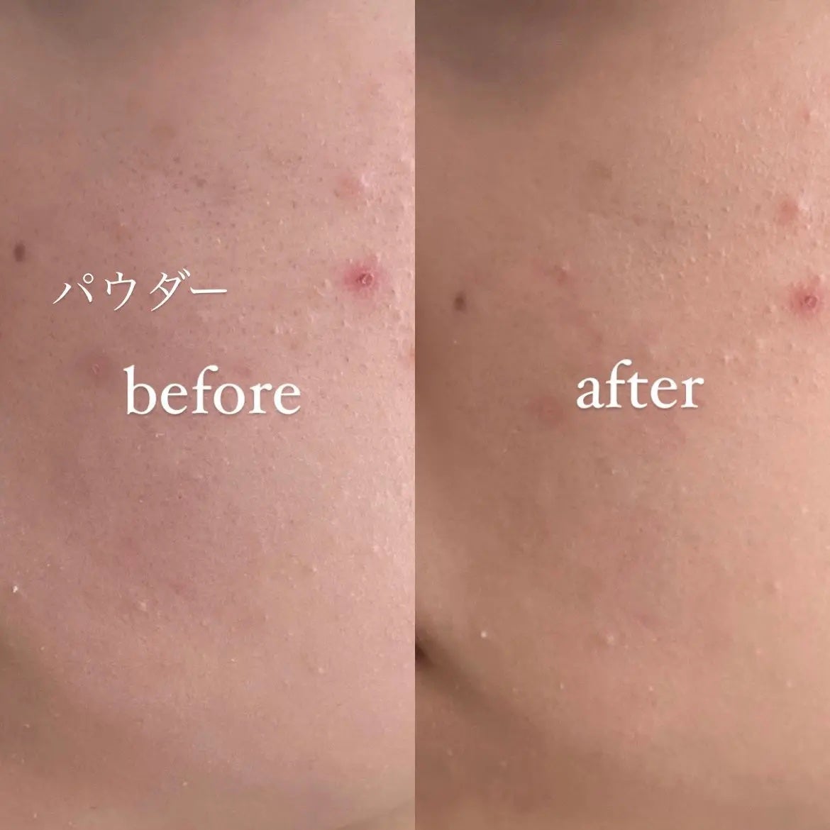 クラウドパウダー/Healus/プレストパウダーを使ったクチコミ(8枚目)