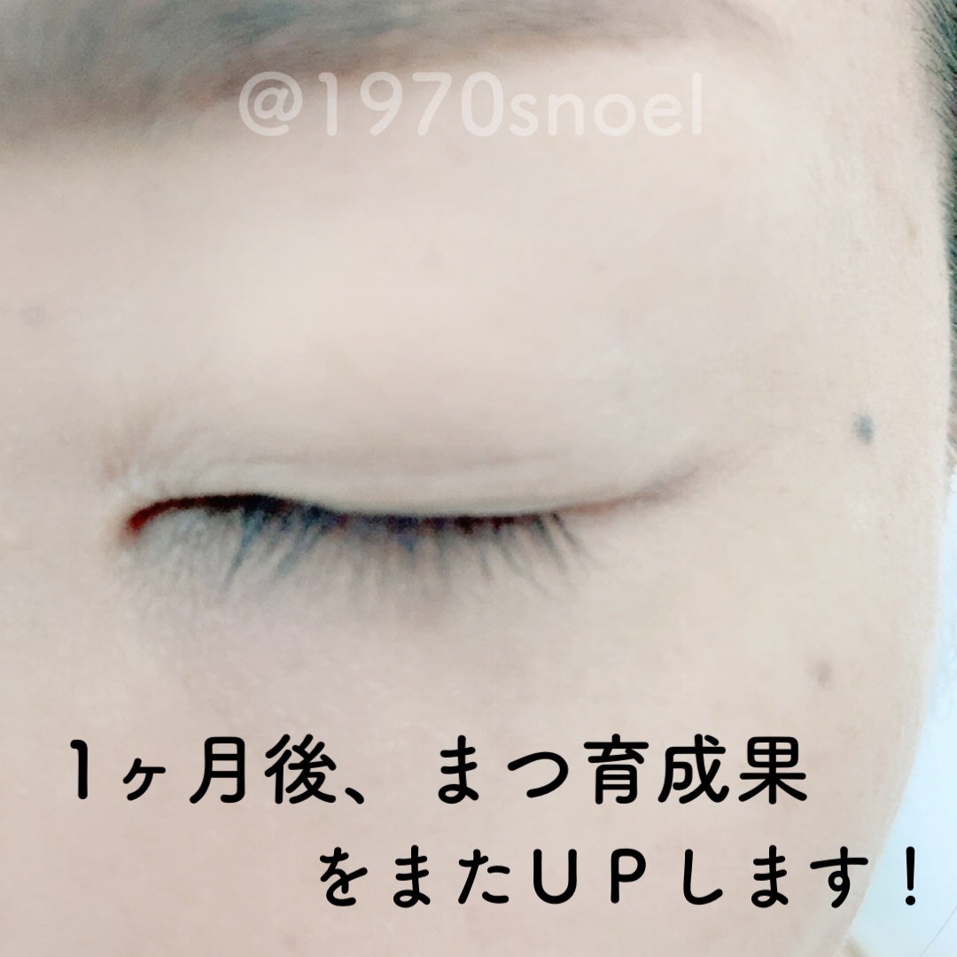 ラッシュリッチアイラッシュセラム/ロート製薬/まつげ美容液を使ったクチコミ(9枚目)