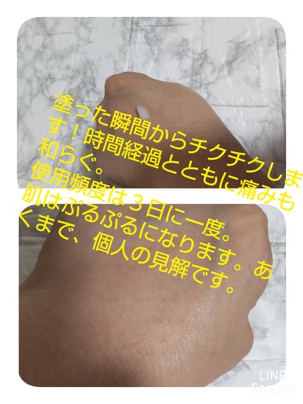 リードルショット100/VT/美容液を使ったクチコミ(2枚目)