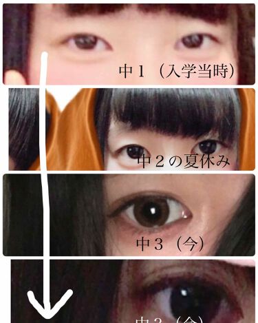 ダブルアイリキッド Abを使った口コミ 今までいろんなことをしても二重になってく By ひまわり 脂性肌 10代後半 Lips