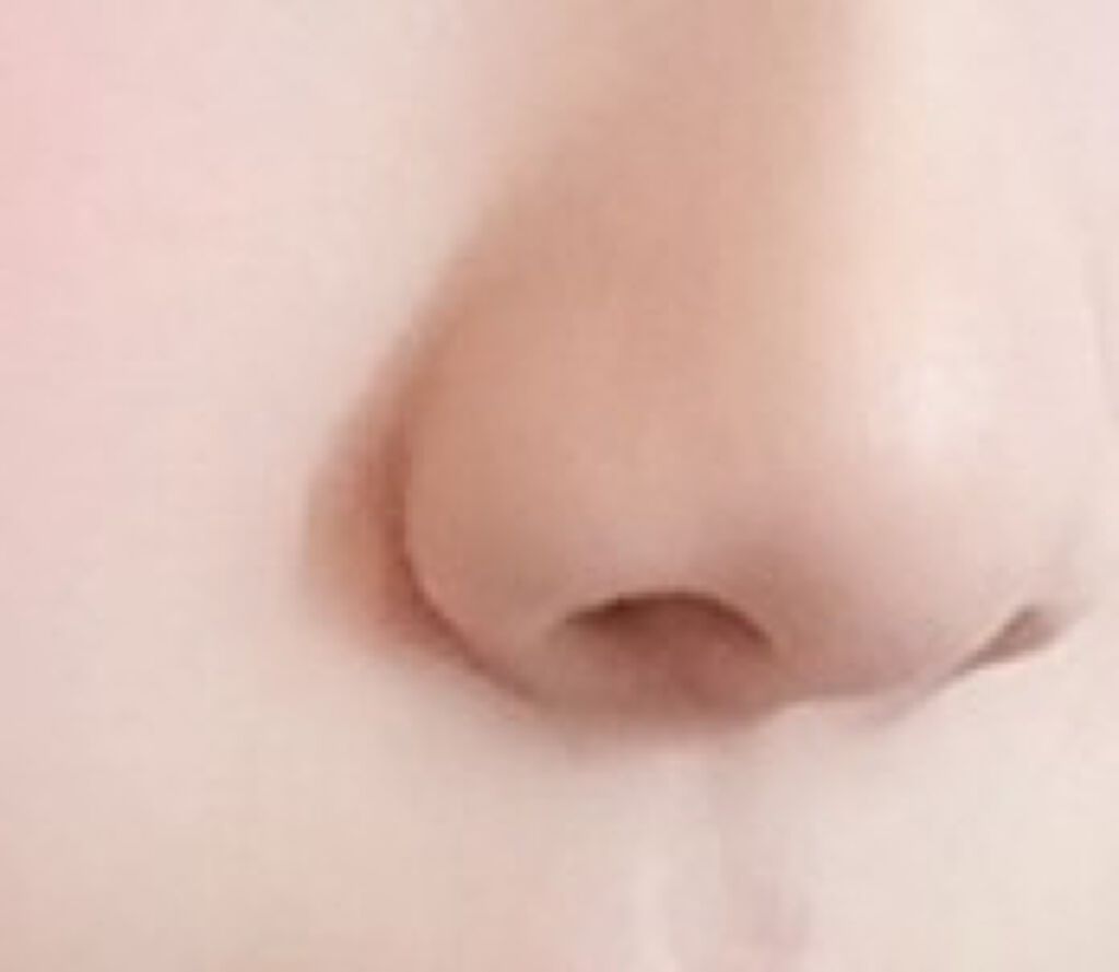 オロナインH軟膏 (医薬品)/オロナイン/その他を使ったクチコミ(2枚目)