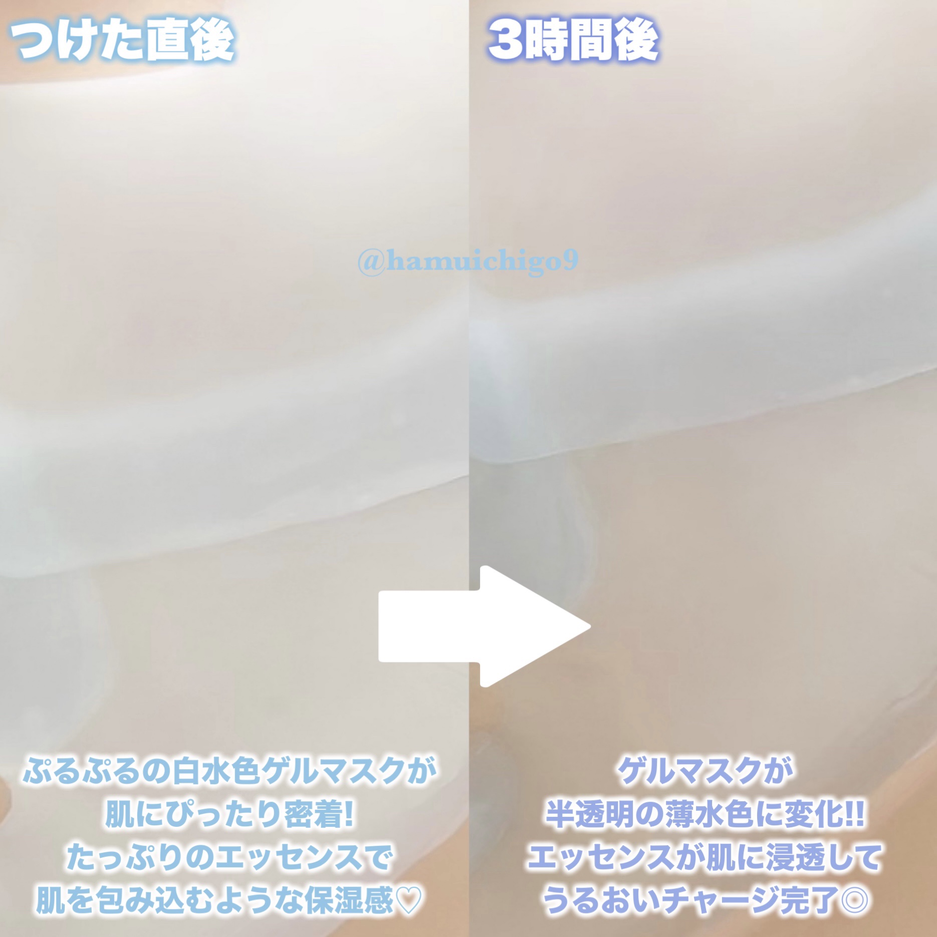 ハイドロップリードルS 100hL 2ステップハイドロゲルマスク/VT/シートマスク・パックを使ったクチコミ（3枚目）