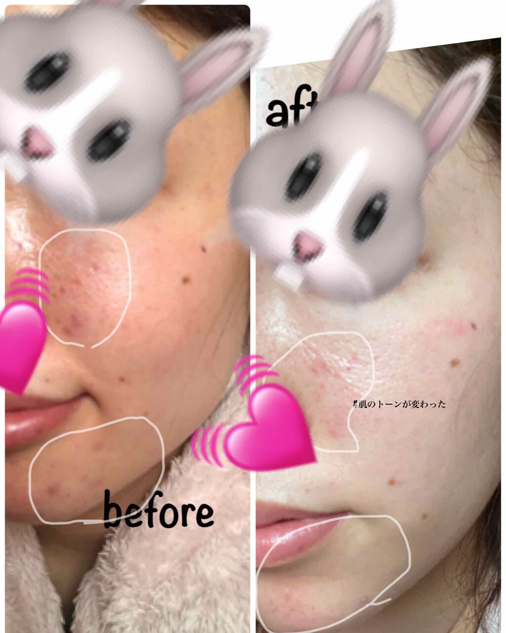 デュオ ザ クレンジングバーム/DUO/クレンジングバームを使ったクチコミ(1枚目)