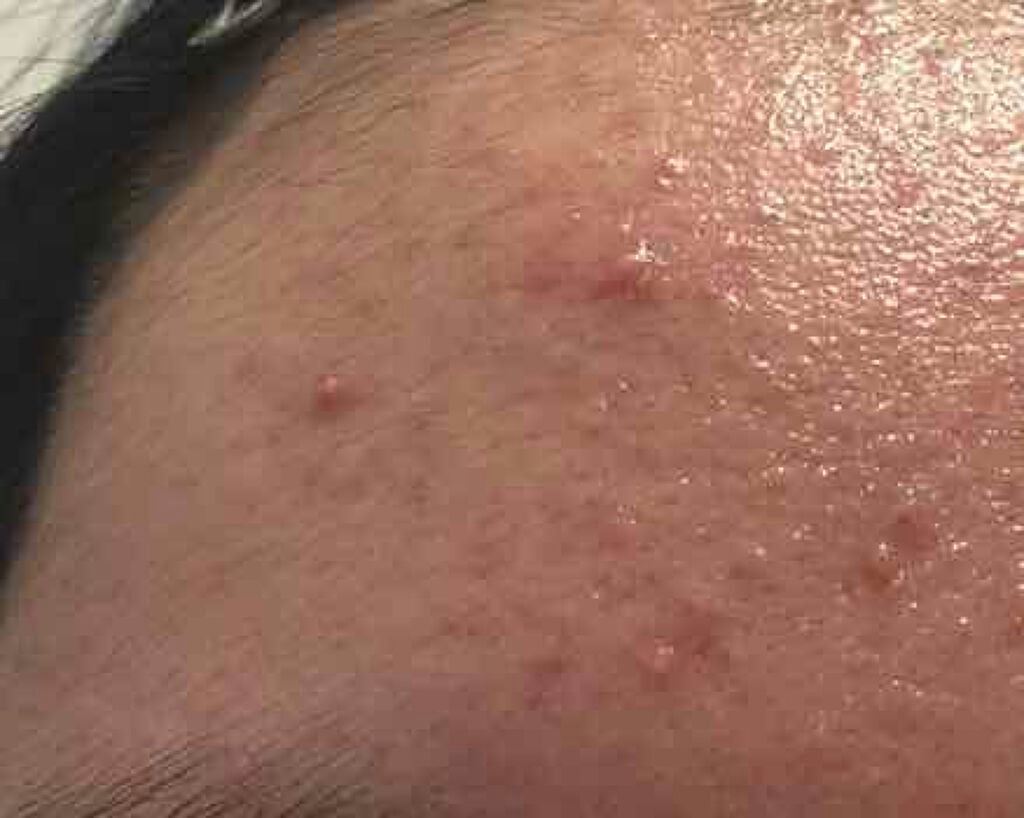 薬用保湿化粧水/オードムーゲ/化粧水を使ったクチコミ(2枚目)