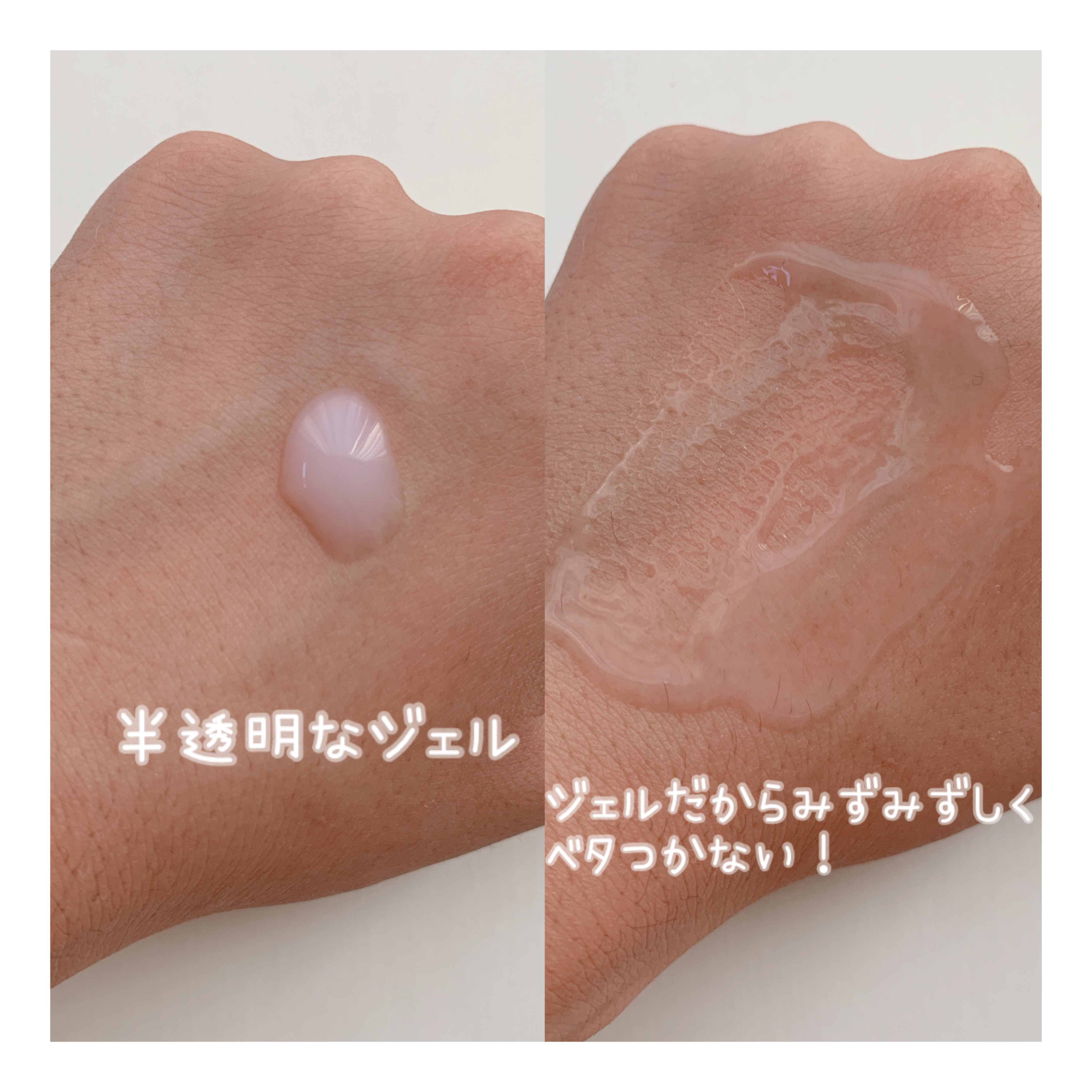 モイスト トリートメント ジェル/アルージェ/美容液を使ったクチコミ（2枚目）