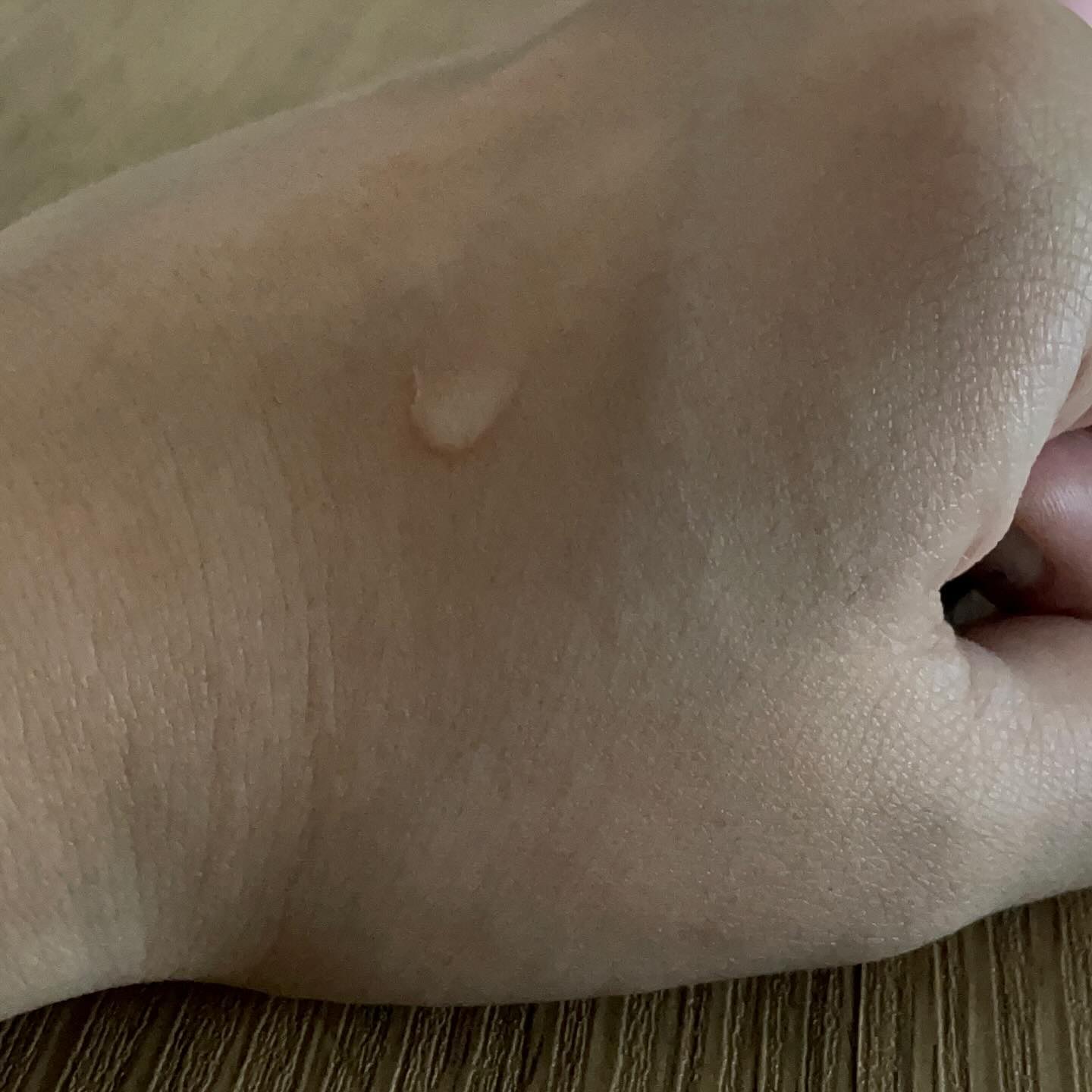 ピンクアロエムチンセラム/APRILSKIN/美容液を使ったクチコミ（2枚目）