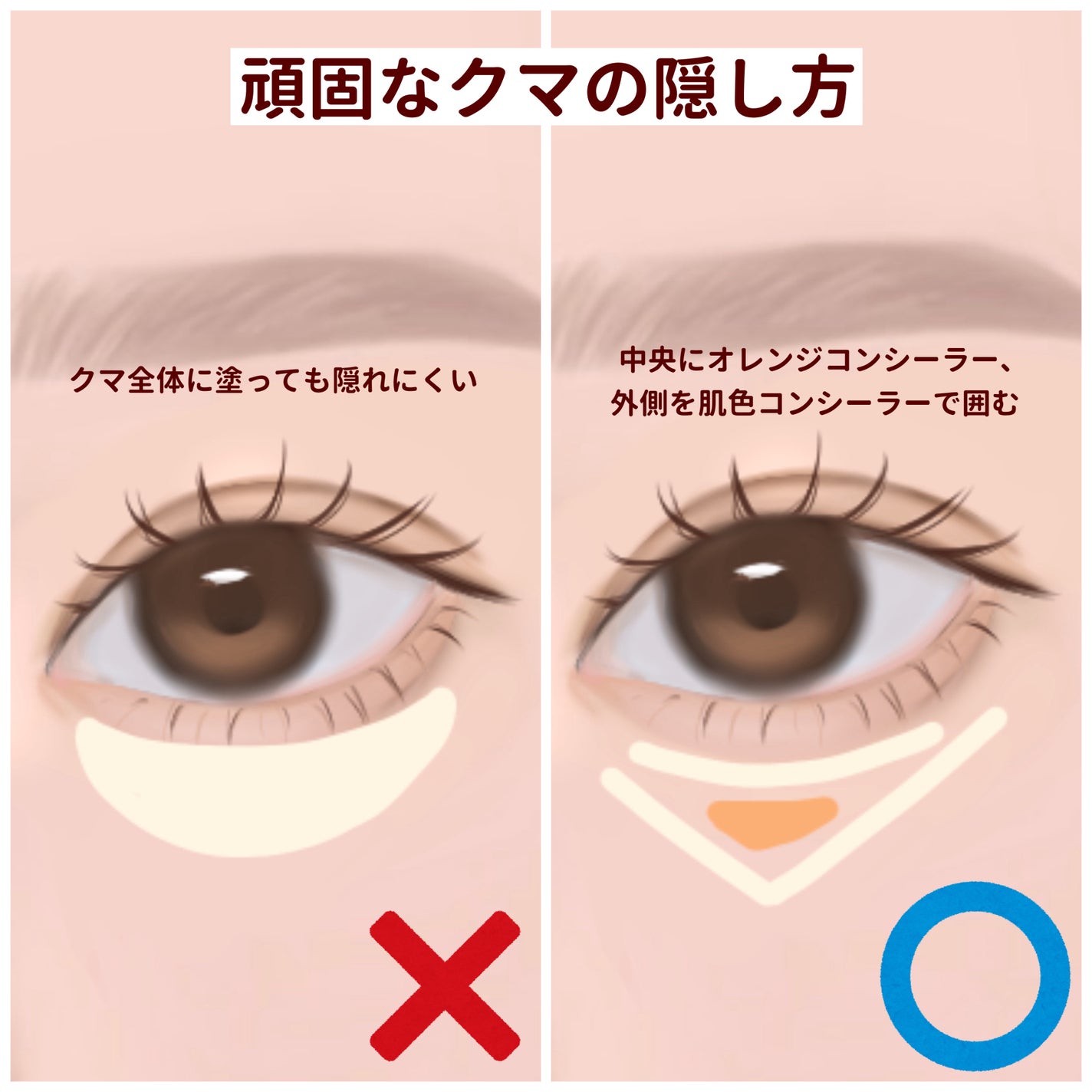 クリエイティブコンシーラーe/IPSA/パレットコンシーラーを使ったクチコミ(5枚目)