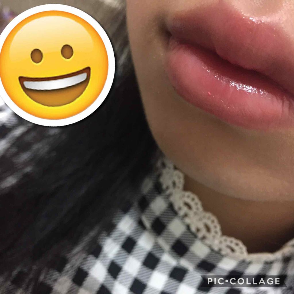 CCリップクリームN/KATE/リップケアを使ったクチコミ（2枚目）