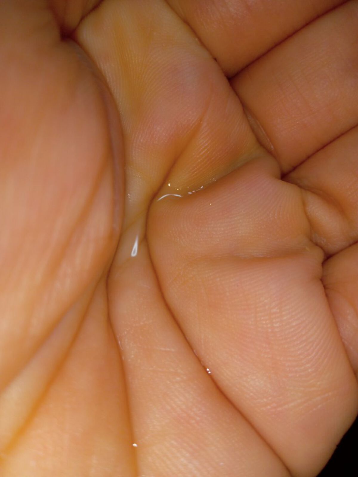 ヒト幹細胞培養エキス原液 15ml/fracora/美容液を使ったクチコミ（2枚目）