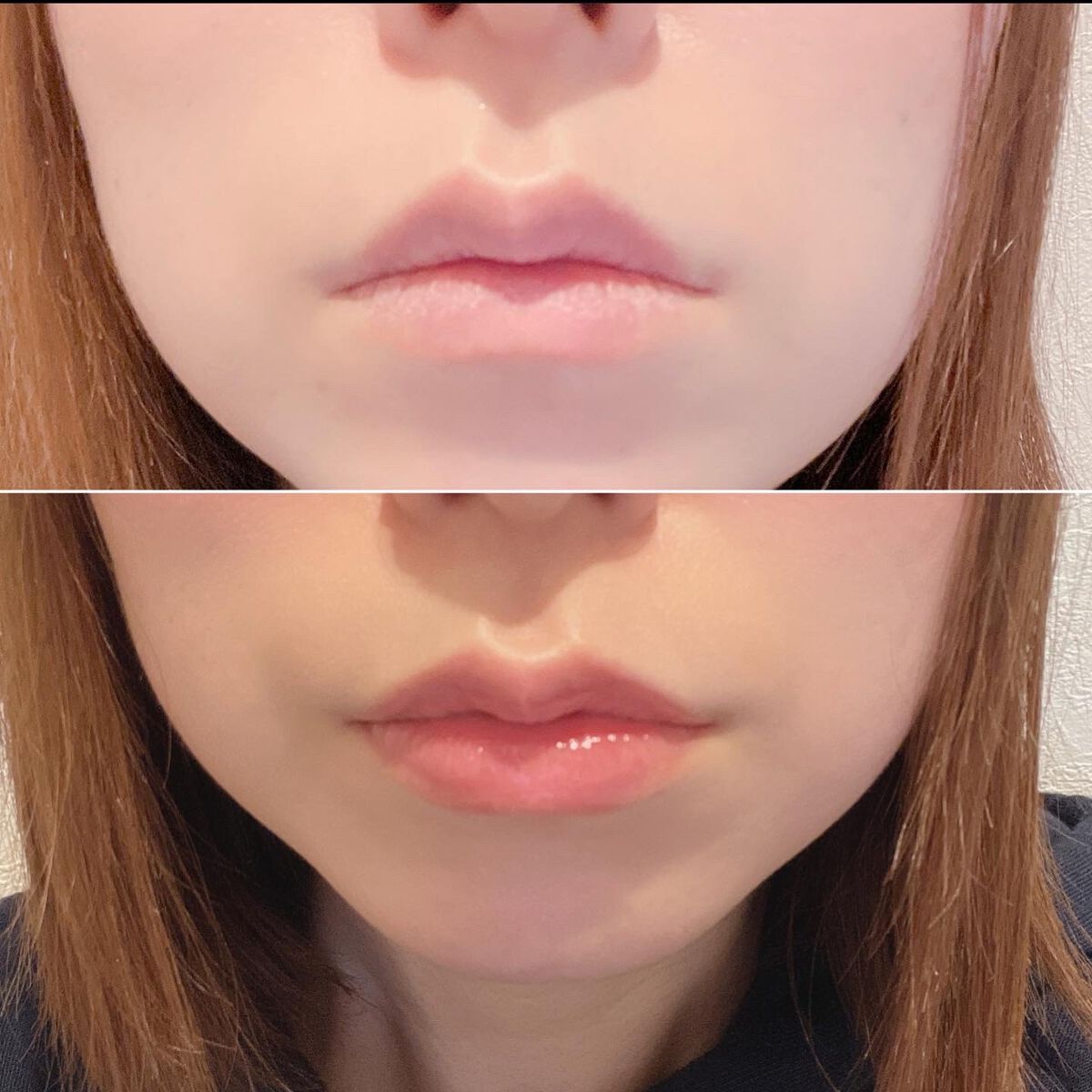 エッセンス リッププランパー/Visée/リッププランパーを使ったクチコミ（2枚目）