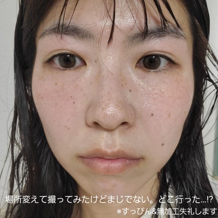 タカミスキンピール/タカミ/ブースター・導入液を使ったクチコミ(9枚目)