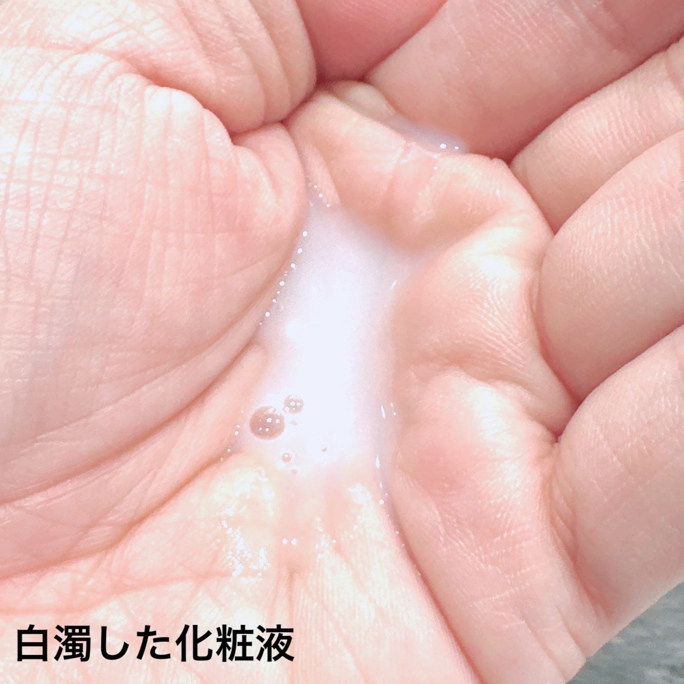 フローラドリップ s/ALBION/化粧水を使ったクチコミ(3枚目)