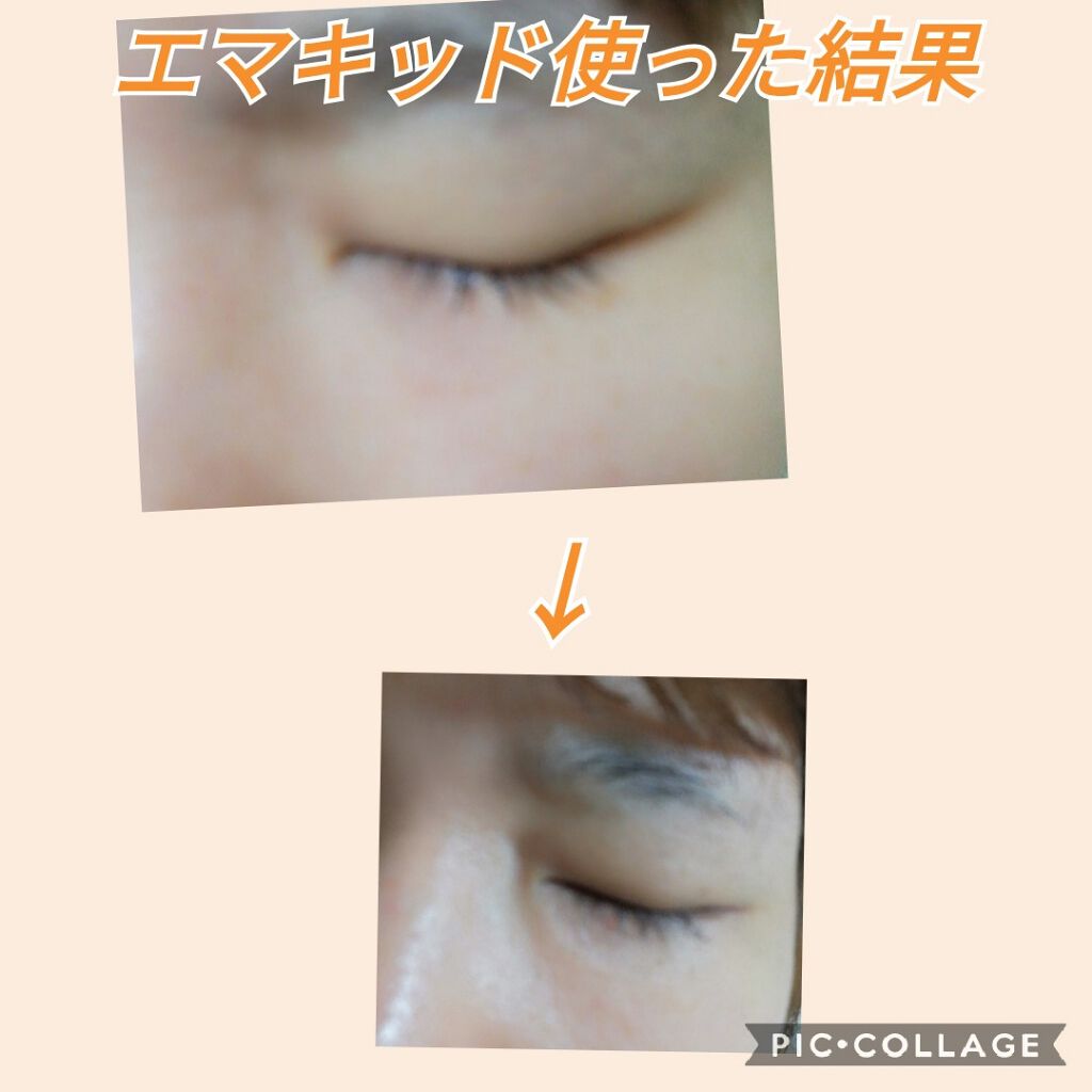 Emaked 水橋保寿堂製薬の効果に関する口コミ まつ育としてエマキッドを約2ヶ月間ぬってみ By ひろ Agm応援してます フォロバ100 脂性肌 30代前半 Lips Emaked 水橋保寿堂製薬の効果に関する口コミ まつ育としてエマキッドを約2ヶ月間ぬってみ By ひろ Agm応援してます フォロバ100 脂性肌 30代前半 Lips
