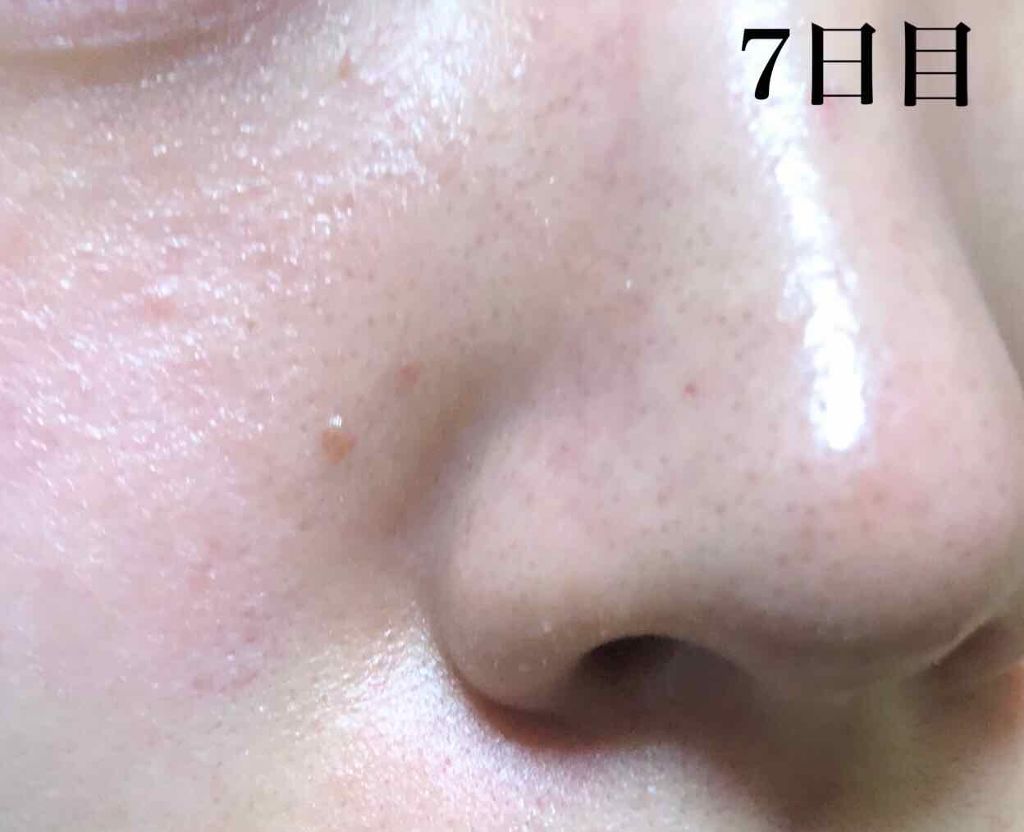 パワーマスク/ラッシュ/洗い流すパック・マスクを使ったクチコミ(4枚目)