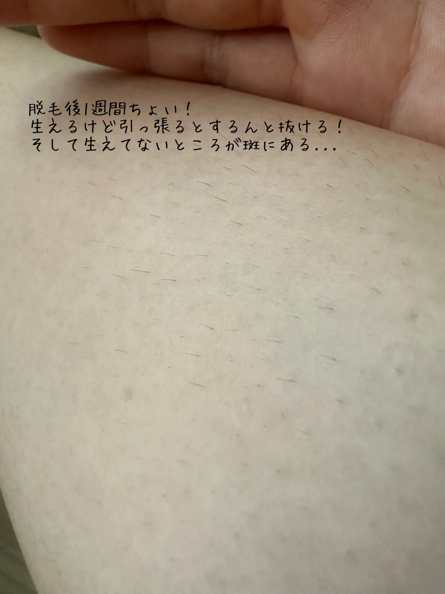 マイルド&モイスチャーアロエジェル/ネイチャーリパブリック/ボディローションを使ったクチコミ(6枚目)