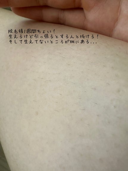 マイルド&モイスチャーアロエジェル/ネイチャーリパブリック/ボディローションを使ったクチコミ(6枚目)