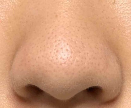 デュオ ザ クレンジングバーム/DUO/クレンジングバームを使ったクチコミ(3枚目)