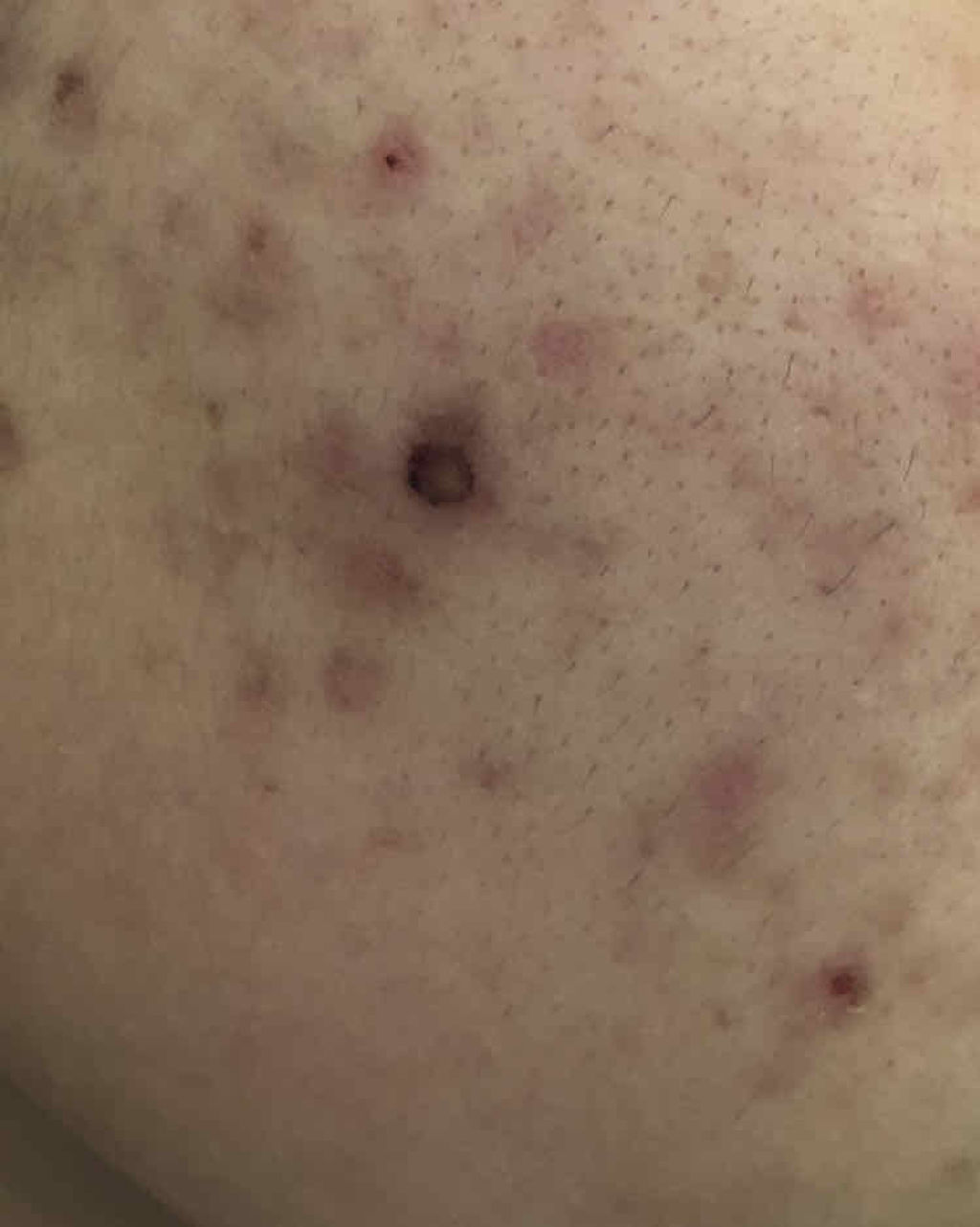 明色美顔水 薬用化粧水/美顔/化粧水を使ったクチコミ（2枚目）