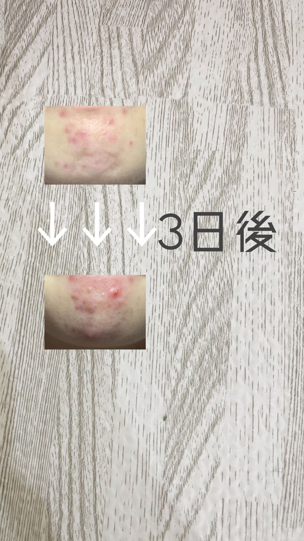 ロゼット洗顔パスタ アクネクリア/ロゼット/洗顔フォームを使ったクチコミ(2枚目)