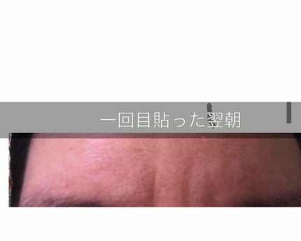 オデコディープパッチ/北の快適工房/シートマスク・パックを使ったクチコミ(4枚目)