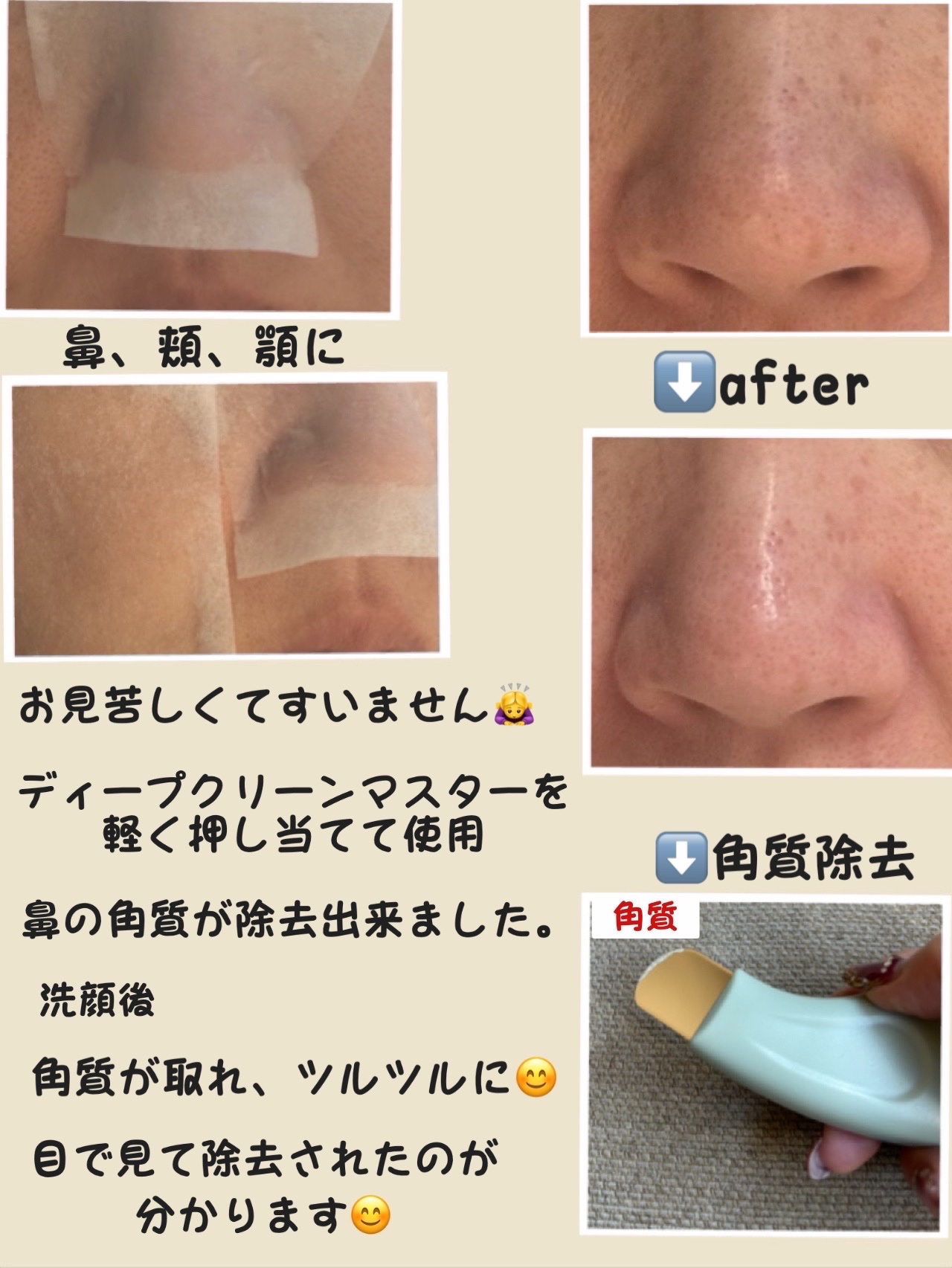 を使ったクチコミ（2枚目）