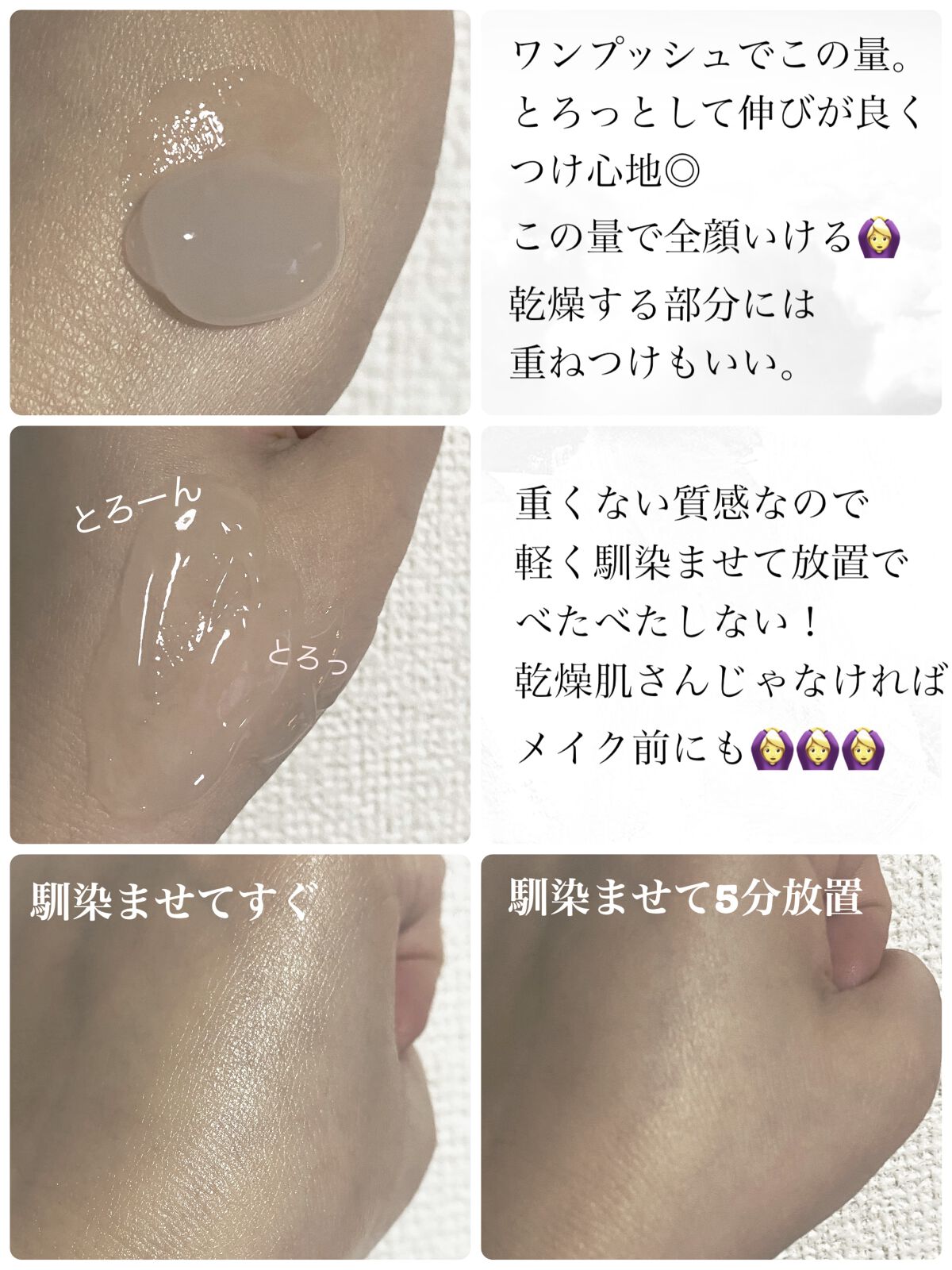 メディプラスゲル/メディプラス/オールインワン化粧品を使ったクチコミ（2枚目）