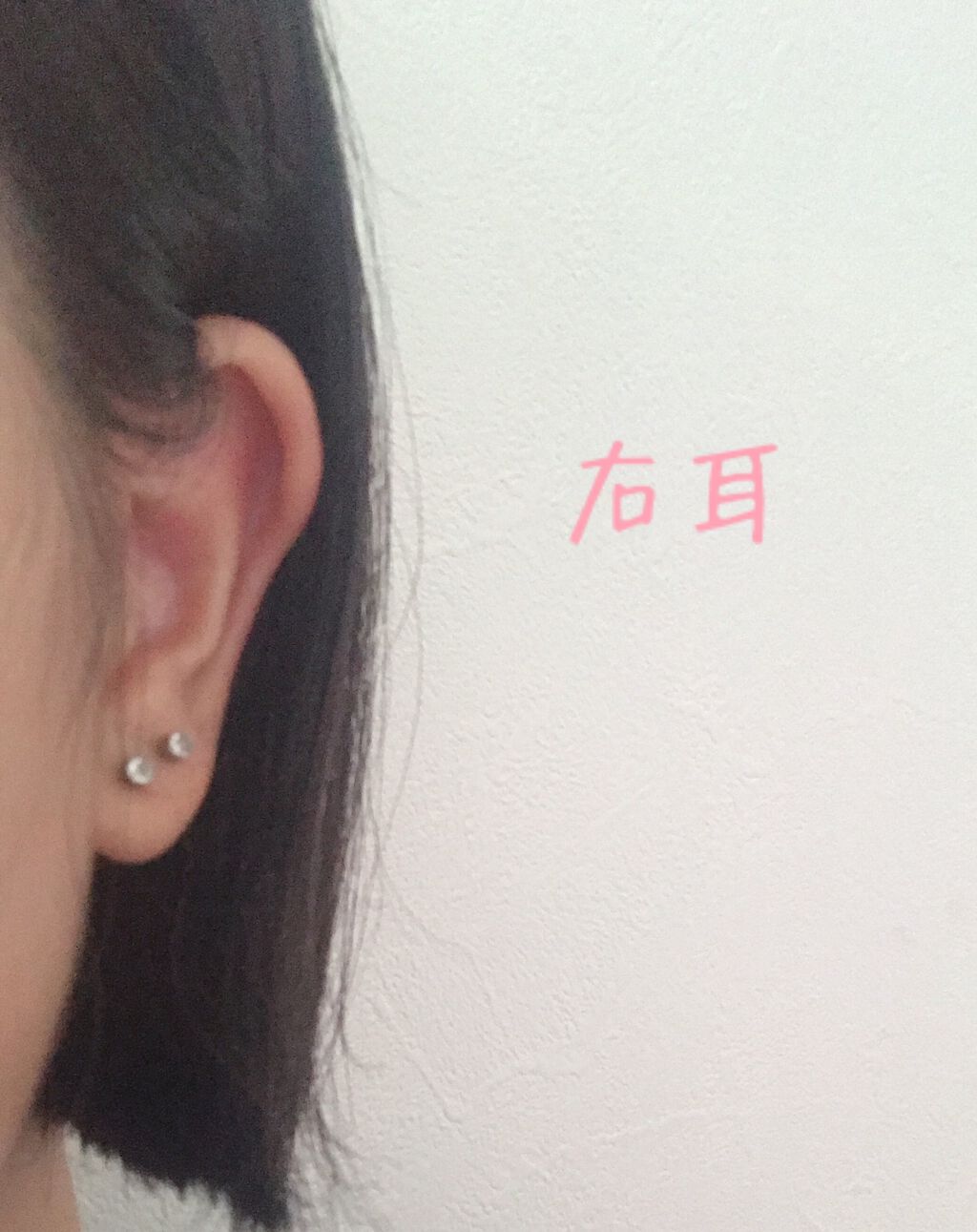 ピアッサー/ピナック/その他を使ったクチコミ（2枚目）