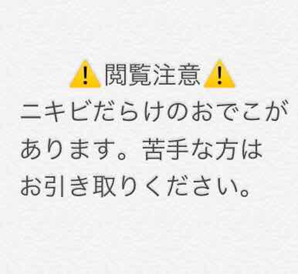 薬用パウダー化粧水/メンソレータム アクネス/化粧水を使ったクチコミ（1枚目）
