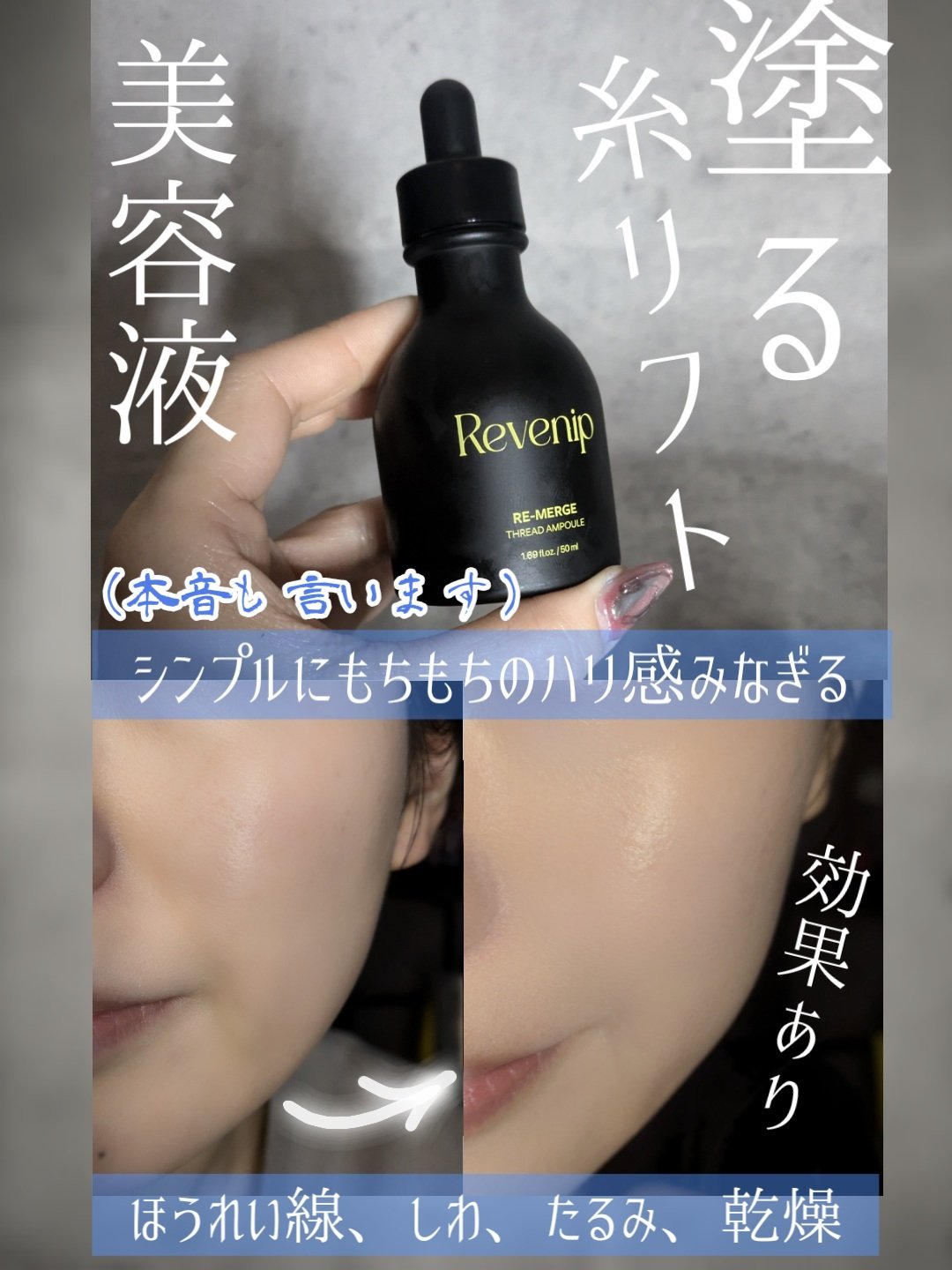 リマージ糸リフティングアンプル/REVENIP/美容液を使ったクチコミ（1枚目）
