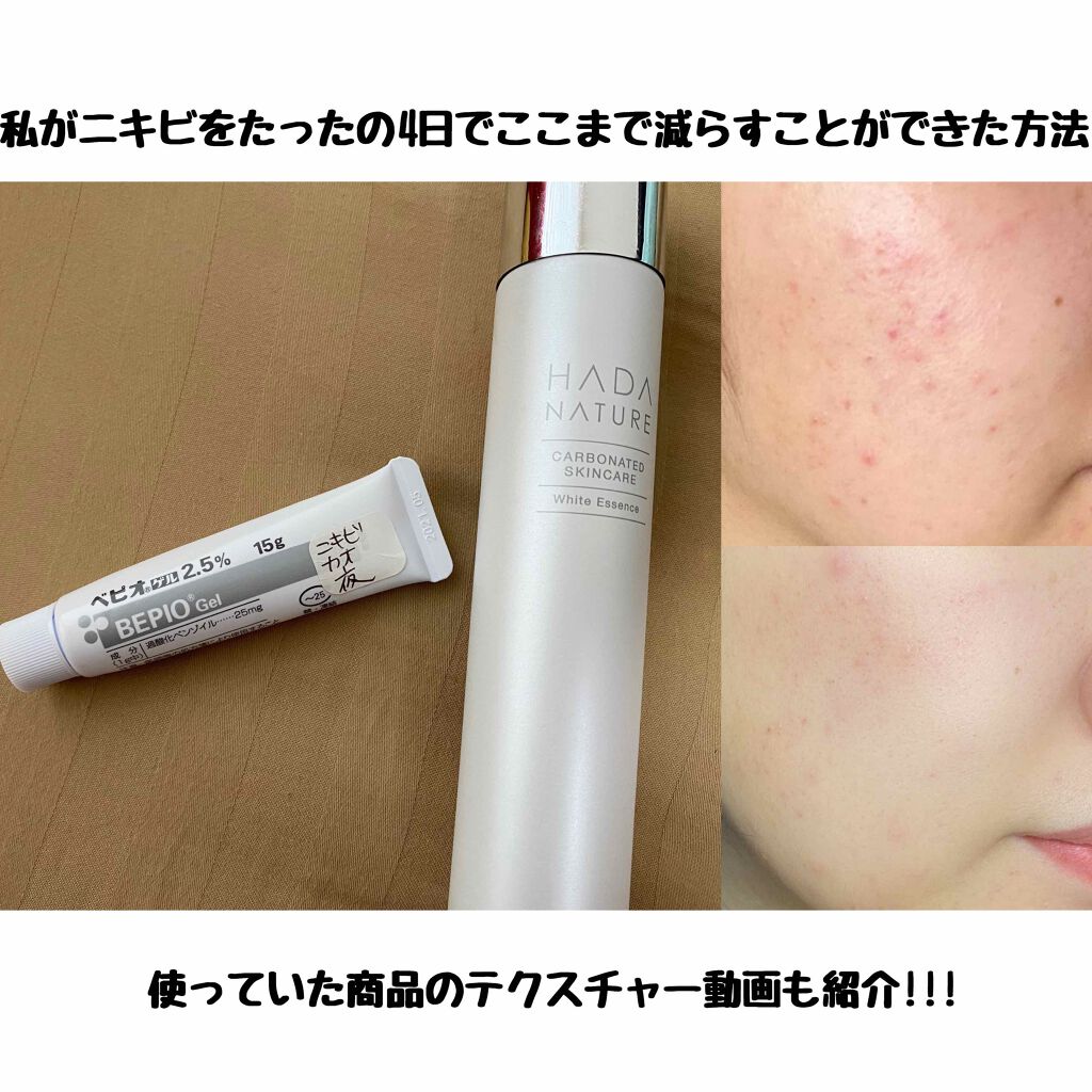 ベピオゲル/マルホ株式会社/その他を使ったクチコミ（1枚目）