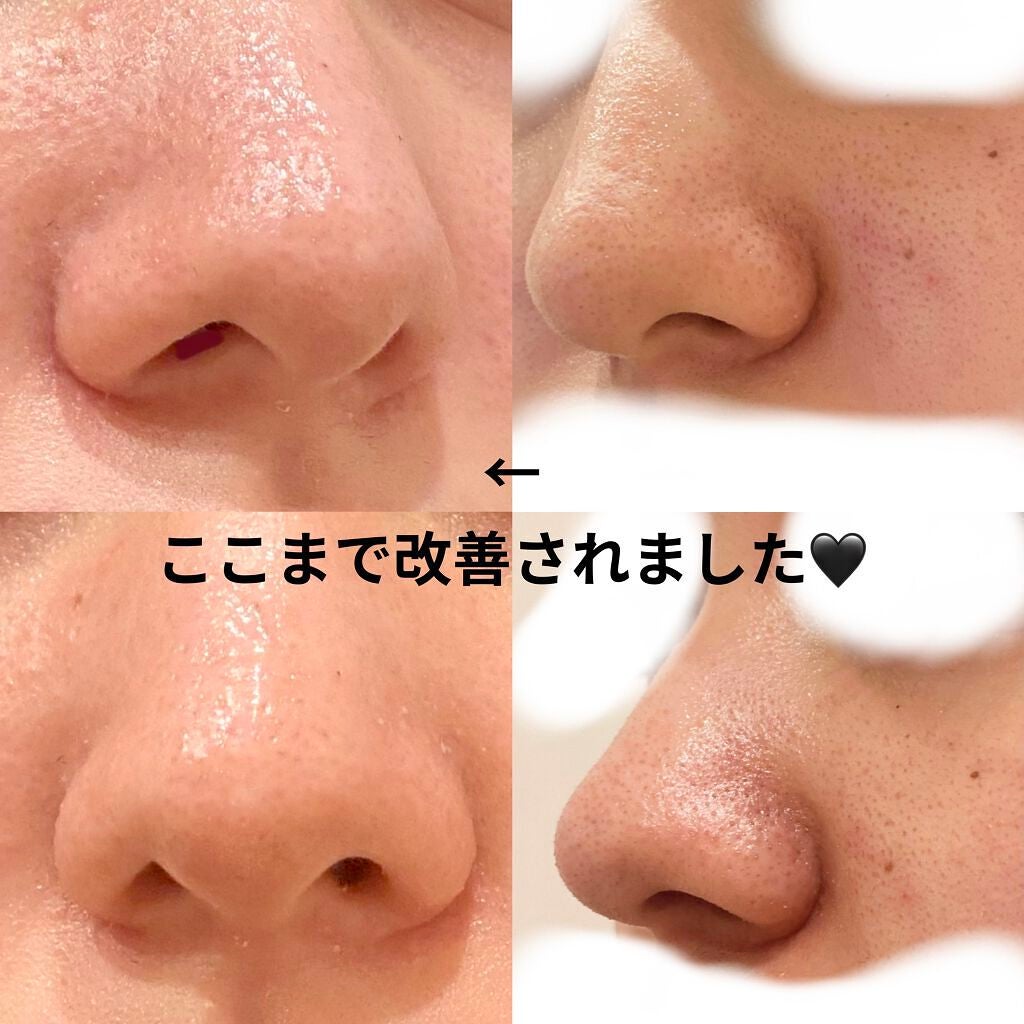 クレイウォッシュ/b.glen/洗顔フォームを使ったクチコミ(1枚目)