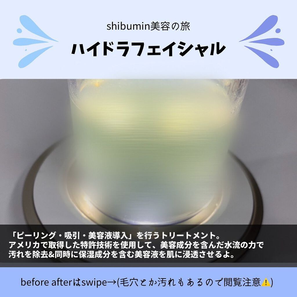 昨年末に行ってきました噂のハイドラフェイシャル💆‍♀️✨

この年齢になるとターンオーバーが乱れがちなので意識的にピーリング化粧品などでケアもしてますが、きちんとクリニックでケアしてもらうことに🏥

施術自体は30分くらいかな。
肌の表