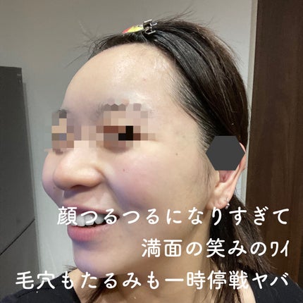 ハンドベール プレミアムリッチネイル/メンソレータム/ネイルオイル・トリートメントを使ったクチコミ(4枚目)