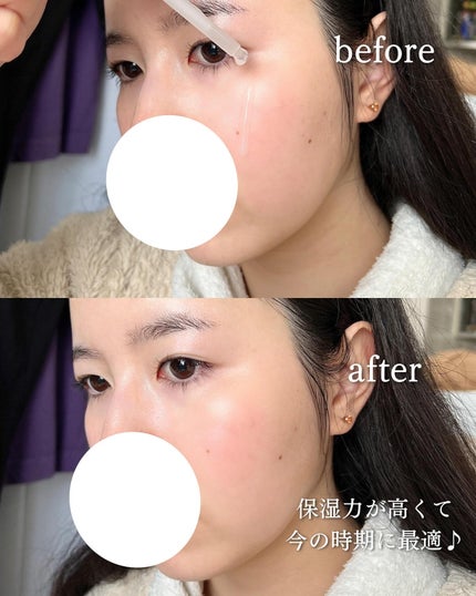 ダーマアンサー PDRN アクティブブースト1:1アンプル/CNP Laboratory/美容液を使ったクチコミ(4枚目)