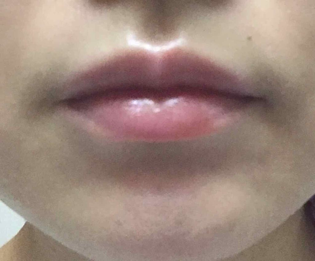 ハニーリップゴマージュ/VECUA/リップケアを使ったクチコミ（3枚目）