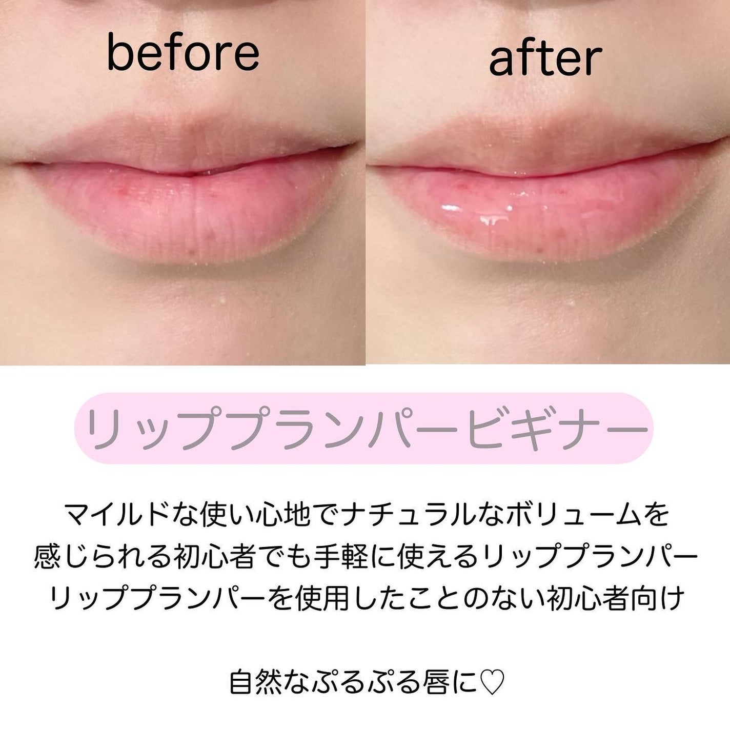 リードルS リッププランパービギナー/VT/リッププランパーを使ったクチコミ(4枚目)