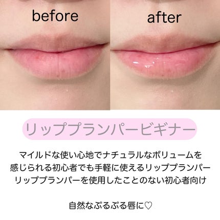 リードルS リッププランパービギナー/VT/リッププランパーを使ったクチコミ(4枚目)