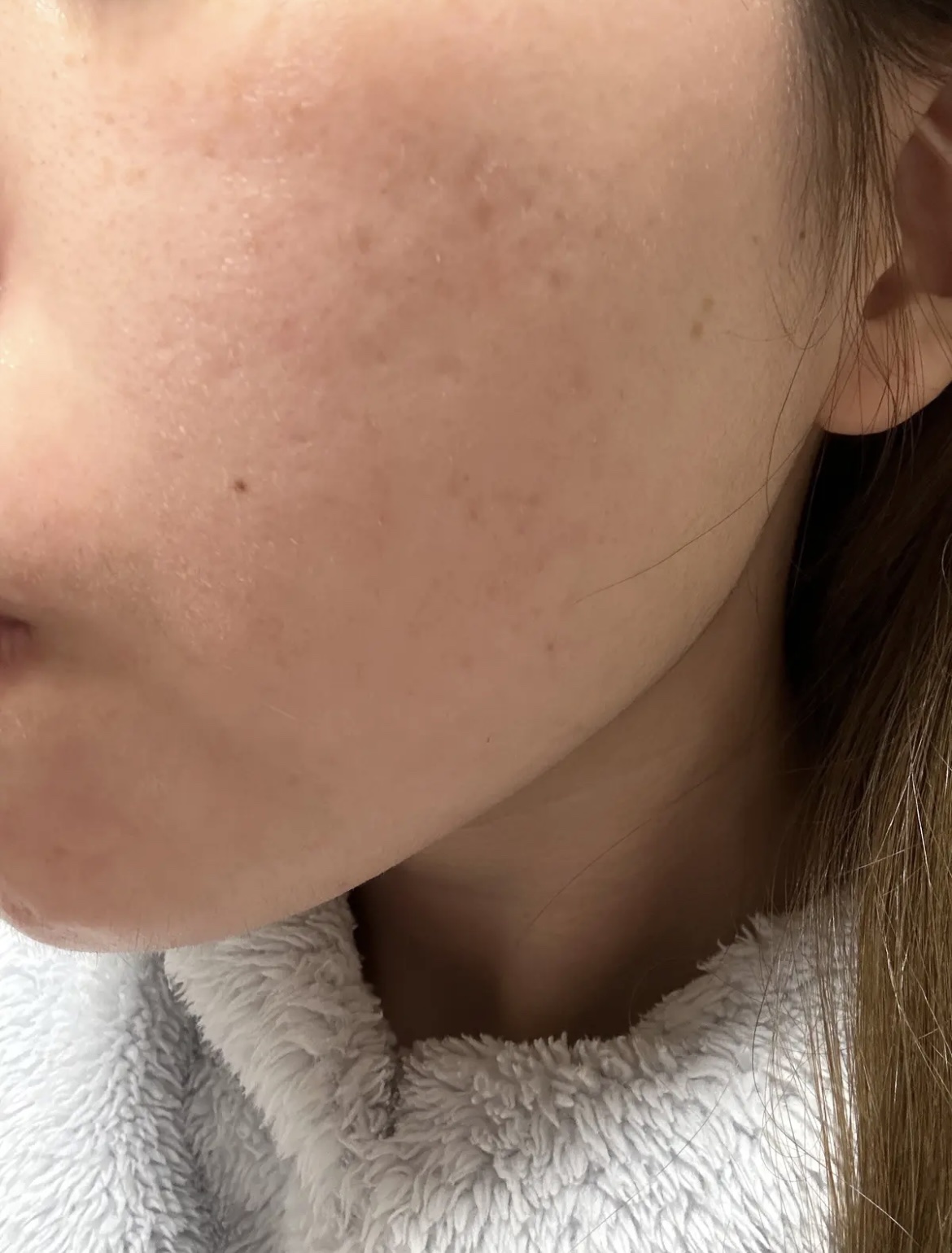 LA10+HAフェイスセラム/The Ordinary/ピーリングを使ったクチコミ（3枚目）